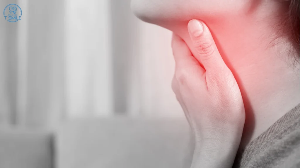 nhổ răng khôn xong bị đau họng