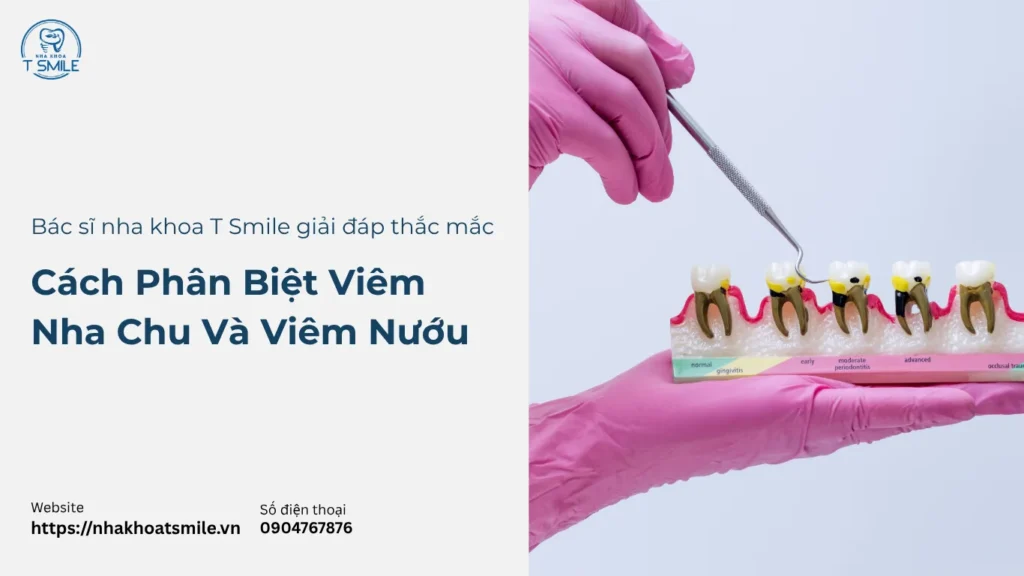 phân biệt viêm nha chu và viêm nướu
