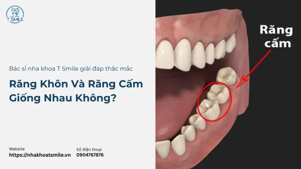 răng khôn và răng cấm có giống nhau không