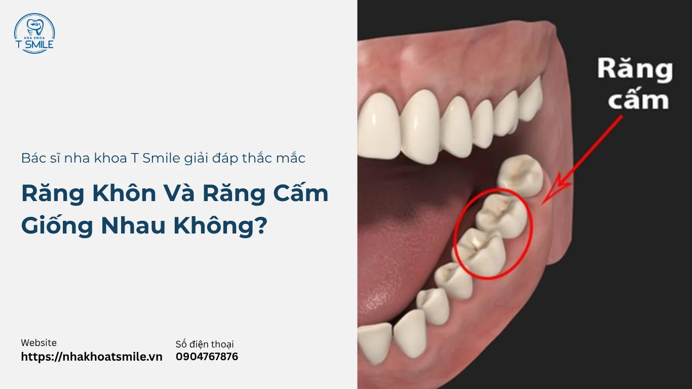 răng khôn và răng cấm có giống nhau không
