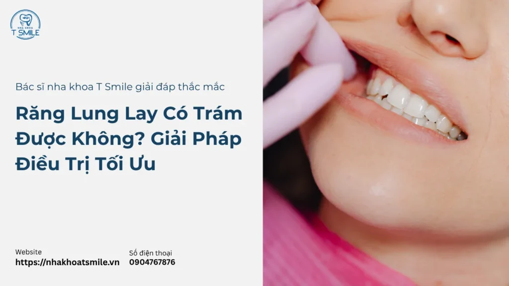 răng lung lay có trám được không