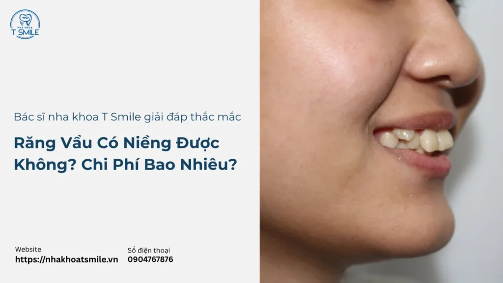 răng vẩu có niềng được không