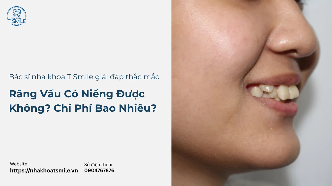 răng vẩu có niềng được không