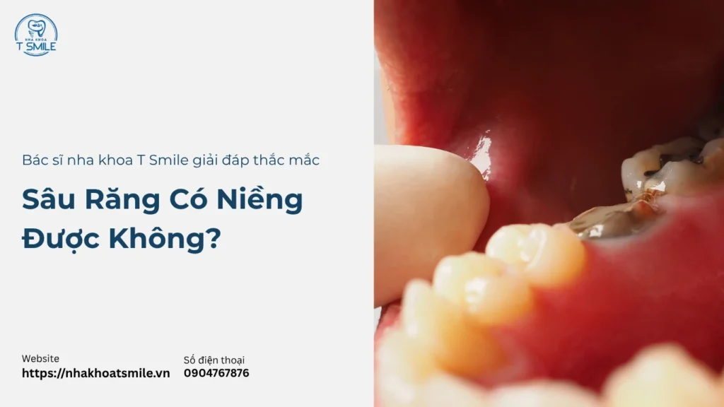 sâu răng có niềng được không