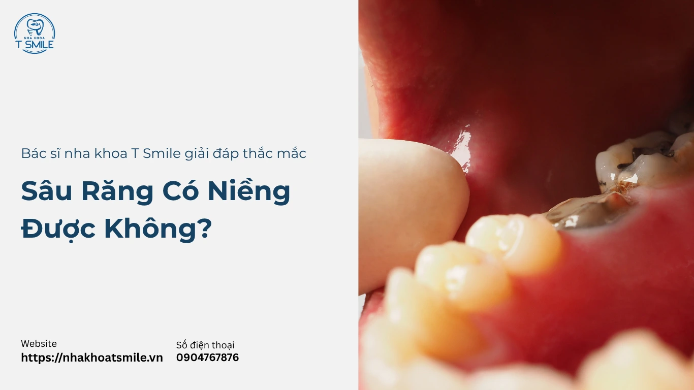 sâu răng có niềng được không