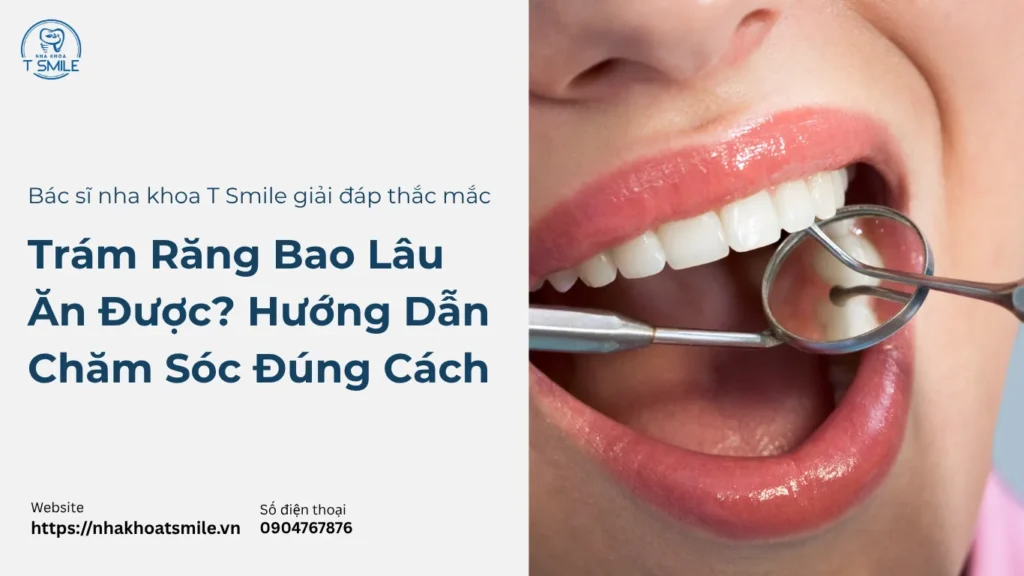 trám răng bao lâu ăn được