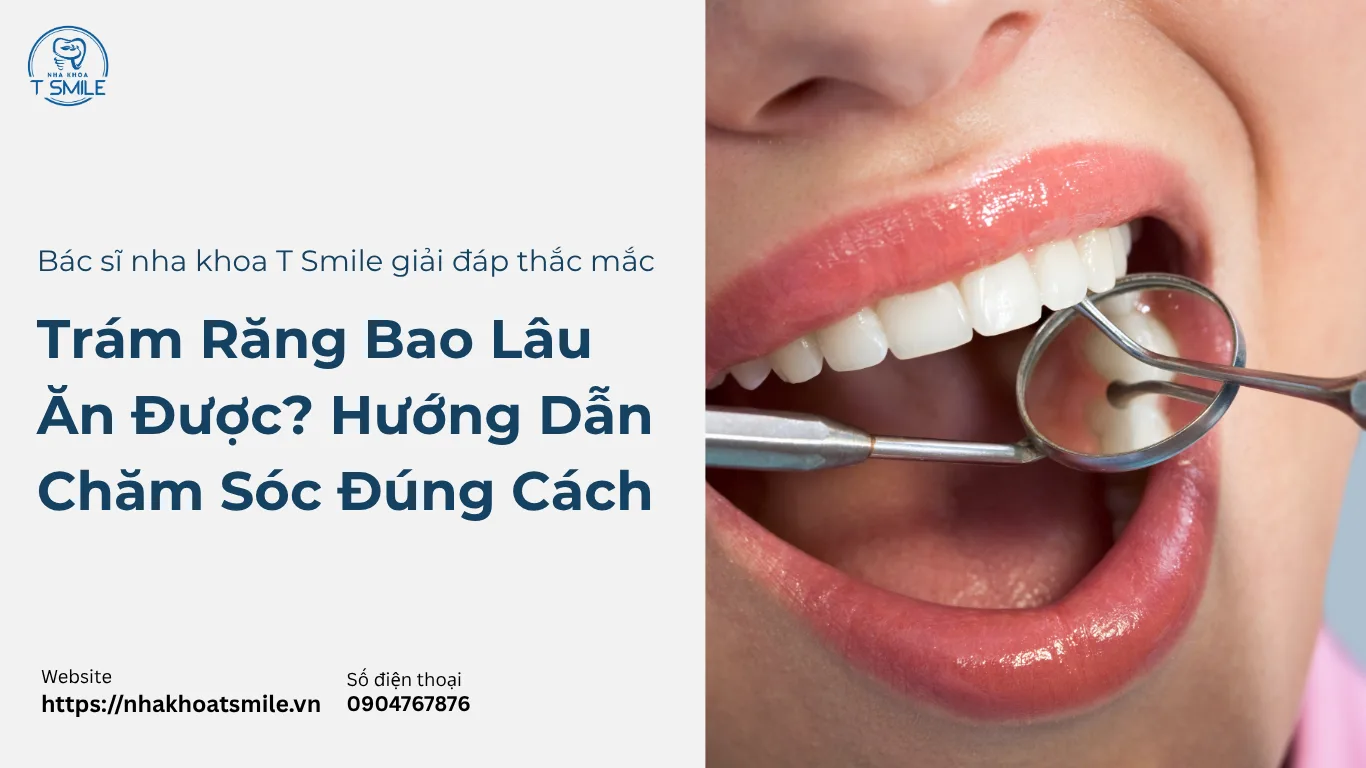 trám răng bao lâu ăn được