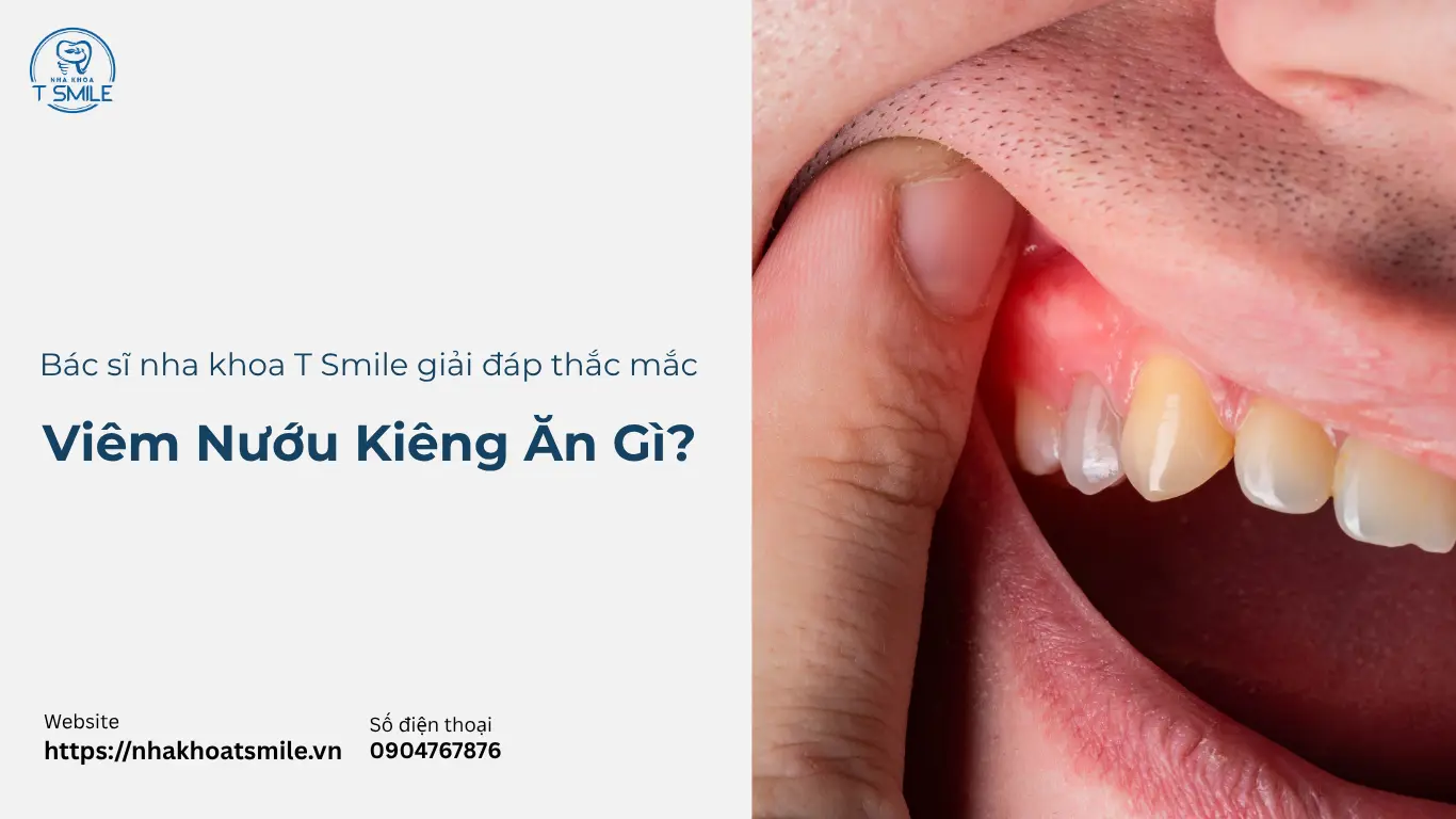 viêm nướu kiêng ăn gì