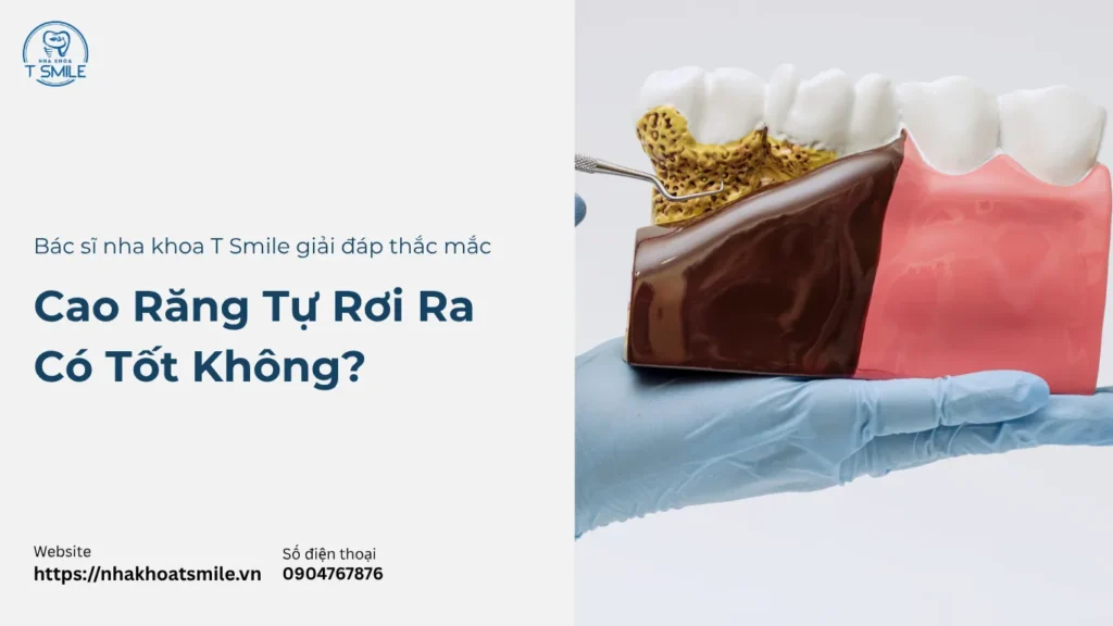 cao răng tự rơi ra có tốt không