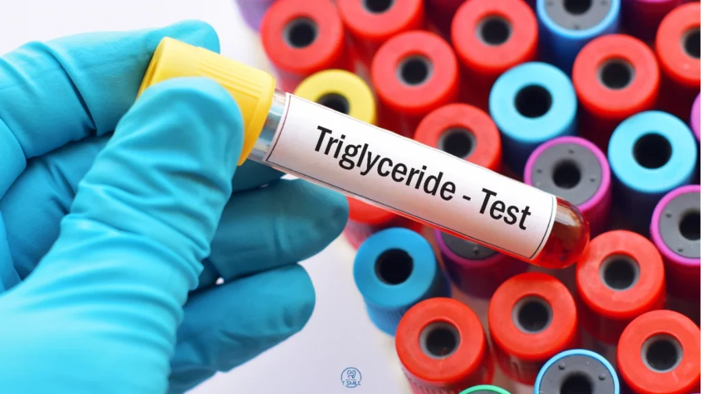 Triglyceride là gì
