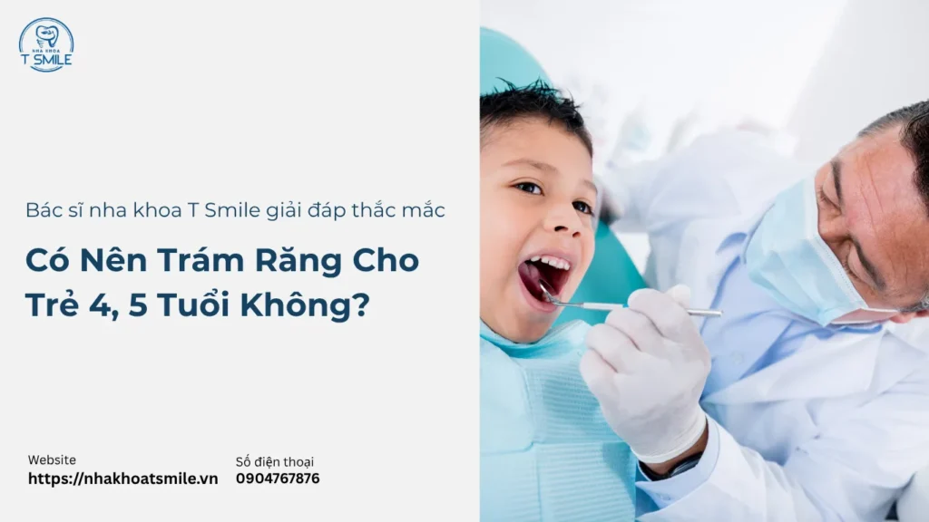 Có nên trám răng cho trẻ 4, 5 tuổi không?