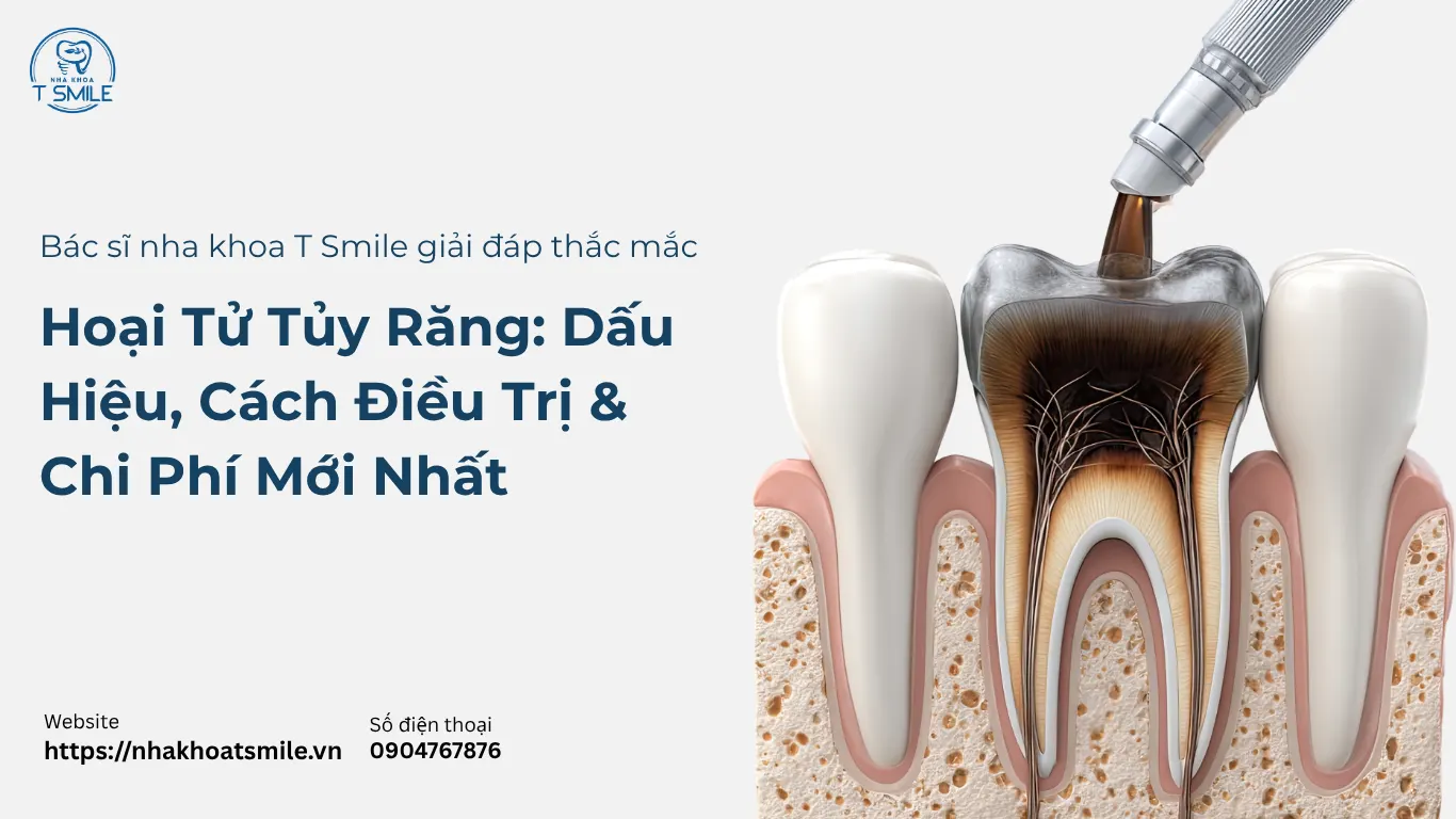 hoại tử tuỷ răng