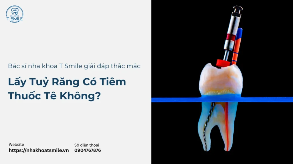 lấy tuỷ răng có tiêm thuốc tê không