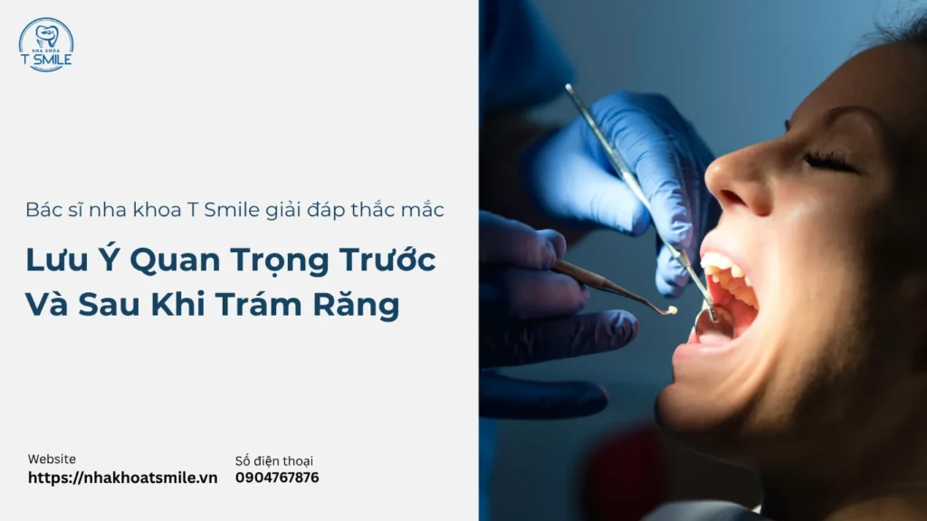 lưu ý khi trám răng