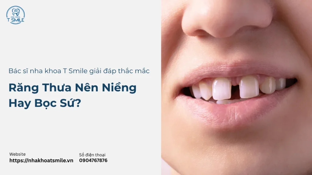 răng thưa nên niềng hay bọc sứ