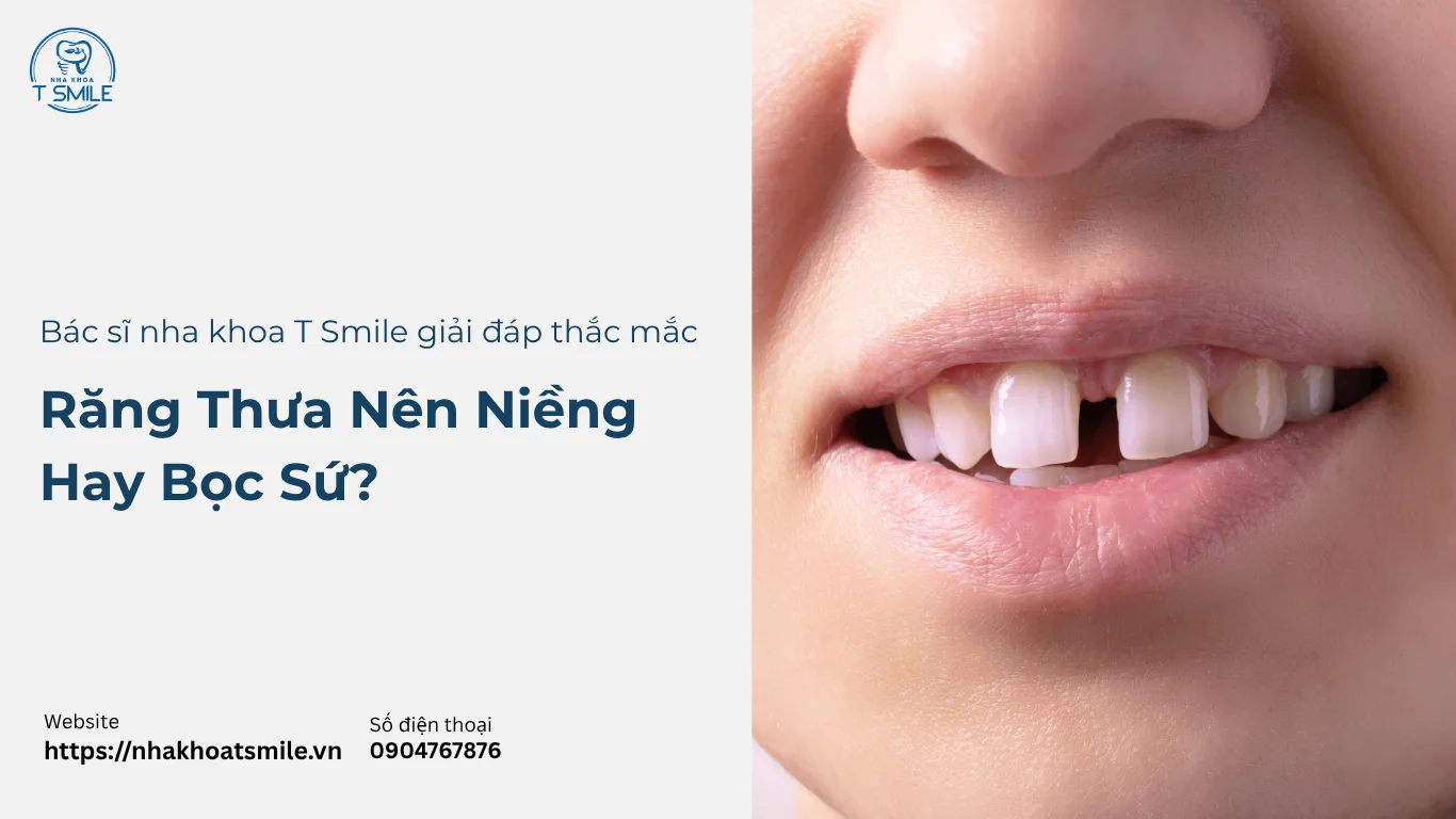 răng thưa nên niềng hay bọc sứ