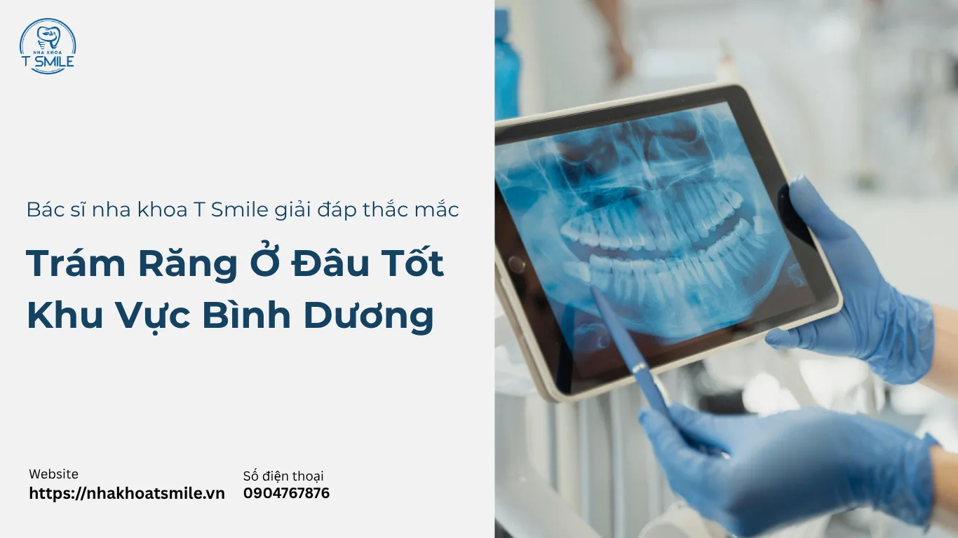 trám răng ở đâu tốt khu vực Bình Dương